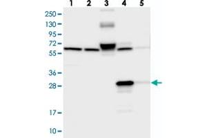 Image no. 1 for anti-Enoyl CoA Hydratase Domain Containing 3 (ECHDC3) antibody (ABIN5576970)
