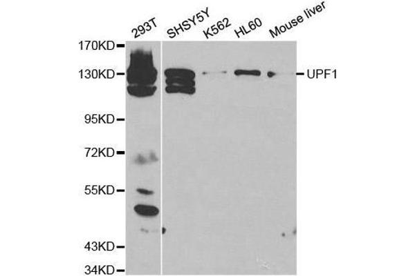 anti-UPF1 Regulator of Nonsense Transcripts Homolog (UPF1) antibody