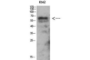 Image no. 1 for anti-Protein Kinase, AMP-Activated, gamma 2 Non-Catalytic Subunit (PRKAG2) (N-Term) antibody (ABIN3183277)