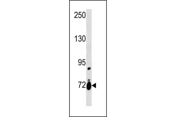 anti-Solute Carrier Family 28 (Sodium-Coupled Nucleoside Transporter), Member 1 (SLC28A1) (AA 381-409) antibody