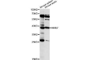 Image no. 1 for anti-Nucleoside Diphosphate Kinase (NME7) antibody (ABIN6293928)