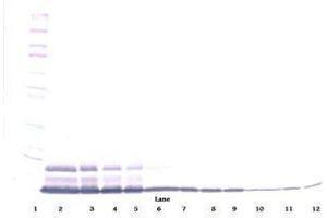 Image no. 2 for anti-Interleukin 8 (IL8) antibody (ABIN465357)