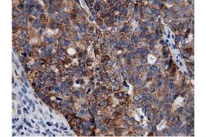 Immunohistochemical staining of paraffin-embedded Human colon tissue using anti-AK5 mouse monoclonal antibody.
