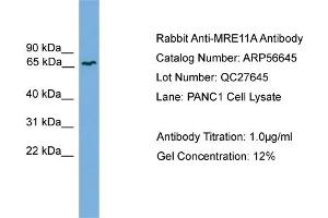 Image no. 1 for anti-MRE11 Meiotic Recombination 11 Homolog A (S. Cerevisiae) (MRE11A) (Middle Region) antibody (ABIN2786814)