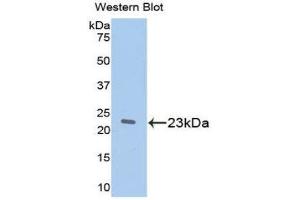 Image no. 1 for anti-Retinol Binding Protein 5, Cellular (RBP5) (AA 19-201) antibody (ABIN1078489)