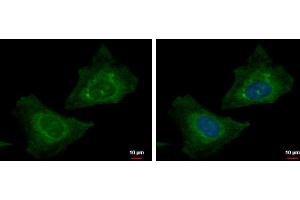 Image no. 2 for anti-Rab Geranylgeranyltransferase, beta Subunit (RABGGTB) (Center) antibody (ABIN2856206)
