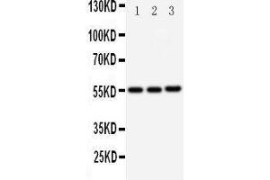 Image no. 3 for anti-Kallikrein 2 (KLK2) (AA 243-261), (C-Term) antibody (ABIN3043140)