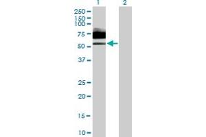 Image no. 1 for anti-Interleukin 6 Receptor (IL6R) (AA 1-468) antibody (ABIN517052)