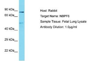 Image no. 1 for anti-Neuroblastoma Breakpoint Family, Member 6 (NBPF6) (C-Term) antibody (ABIN2791688)