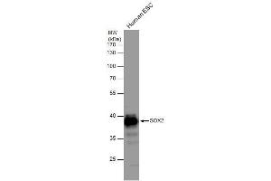 WB Image SOX2 antibody detects SOX2 protein by western blot analysis.