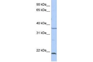 Image no. 1 for anti-Sprouty Homolog 2 (SPRY2) (Middle Region) antibody (ABIN2784218)