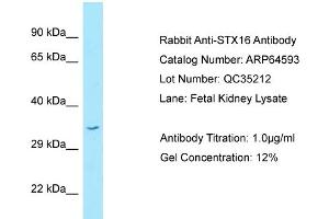 Image no. 1 for anti-Syntaxin 16 (STX16) (C-Term) antibody (ABIN2789888)