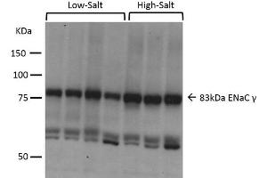 Image no. 4 for anti-Sodium Channel, Nonvoltage-Gated 1 alpha (SCNN1A) (AA 629-650) antibody (ABIN863204)