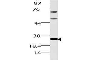 Image no. 1 for anti-Spi-B Transcription Factor (Spi-1/PU.1 Related) (SPIB) (AA 50-260) antibody (ABIN5027543)