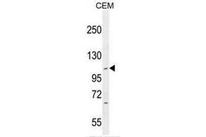 Image no. 4 for anti-Intraflagellar Transport 88 Homolog (IFT88) (AA 798-827), (C-Term) antibody (ABIN952829)