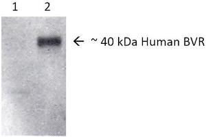 Image no. 2 for anti-Biliverdin Reductase A (BLVRA) antibody (FITC) (ABIN2482003)