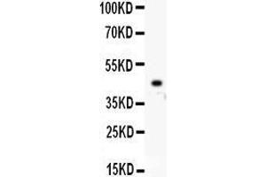 Image no. 2 for anti-Homeobox A10 (HOXA10) (AA 57-340) antibody (ABIN3042453)