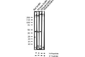 Synaptotagmin anticorps  (pSer309)