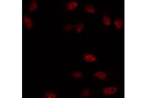 Image no. 5 for anti-SNAIL (SNAI1) (C-Term) antibody (ABIN6265200)