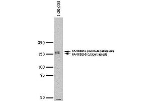 anti-Fanconi Anemia, Complementation Group D2 (FANCD2) (N-Term) antibody