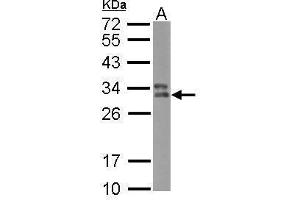 Image no. 1 for anti-Major Histocompatibility Complex, Class II, DP beta 1 (HLA-DPB1) (Center) antibody (ABIN2855479)