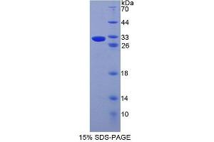ABCD4 Protein (AA 356-606) (T7 tag,His tag)