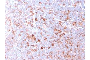 Image no. 6 for anti-CD40 Ligand (CD40LG) (AA 108-261) antibody (ABIN6941188)