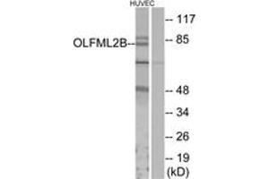 Image no. 1 for anti-Olfactomedin-Like 2B (OLFML2B) (AA 171-220) antibody (ABIN1535843)