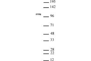 Image no. 1 for anti-Piwi-Like 2 (PIWIL2) antibody (ABIN6972356)