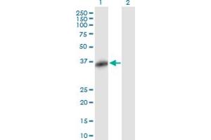 Image no. 1 for anti-F-Box Protein 32 (FBXO32) (AA 1-355) antibody (ABIN530307)