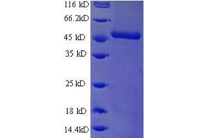DCUN1D1 Protein (Defective in Cullin Neddylation 1, Domain Containing 1) (AA 1-259, full length) (His-SUMO Tag)