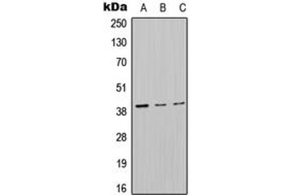 anti-Mitochondrially Encoded NADH Dehydrogenase 2 (MT-ND2) (Center) antibody