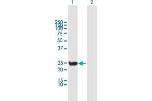 CINP antibody  (AA 1-212)