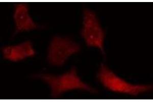 Image no. 3 for anti-Nucleolar and Spindle Associated Protein 1 (NUSAP1) (C-Term) antibody (ABIN6257881)