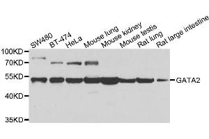 Image no. 1 for anti-GATA Binding Protein 2 (GATA2) antibody (ABIN3021051)