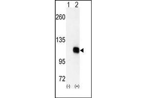 Image no. 1 for anti-Diacylglycerol Kinase, zeta (DGKZ) (C-Term) antibody (ABIN360519)