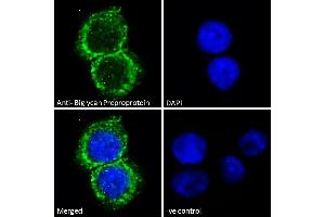 Image no. 4 for anti-Biglycan (BGN) (C-Term) antibody (ABIN334359)