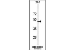 Image no. 1 for anti-Sestrin 2 (SESN2) (AA 283-311) antibody (ABIN652222)