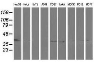 Image no. 2 for anti-Alcohol Dehydrogenase 1B (Class I), beta Polypeptide (ADH1B) antibody (ABIN1496477)