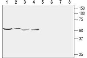 Western blot analysis of rat brain (lanes 1 and 5), mouse brain (lanes 2 and 6), rat pancreas (lanes 3 and 7) and rat pituitary (lanes 4 and 8): - 1,2,4.