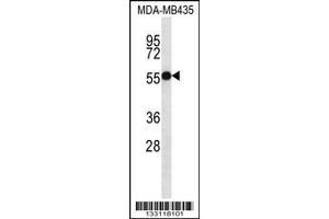 Image no. 1 for anti-Ankyrin Repeat and SOCS Box Containing 4 (ASB4) (AA 226-255), (C-Term) antibody (ABIN657170)