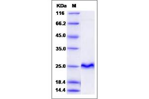 Image no. 1 for Cysteine-Rich Protein 2 (CRIP2) (AA 1-208) protein (ABIN2006235)