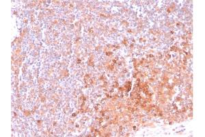 Image no. 6 for anti-Tumor Necrosis Factor Receptor Superfamily, Member 4 (TNFRSF4) (AA 59-205) antibody (ABIN6940817)