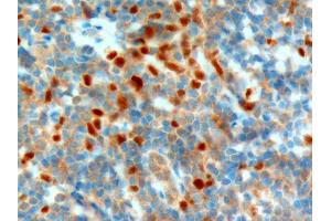 Image no. 1 for anti-Neuroepithelial Cell Transforming 1 (NET1) (C-Term) antibody (ABIN185112)