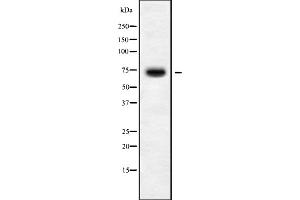 Image no. 1 for anti-Kelch-Like 36 (KLHL36) (Internal Region) antibody (ABIN6260358)