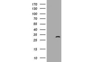 Image no. 1 for anti-Zinc Finger, FYVE Domain Containing 21 (ZFYVE21) antibody (ABIN1501820)