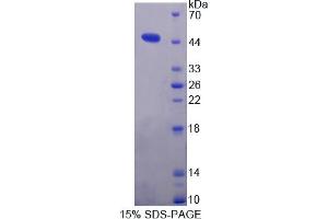 Image no. 1 for Microsomal Triglyceride Transfer Protein (MTTP) (AA 28-459) protein (T7 tag,His tag) (ABIN6236898)