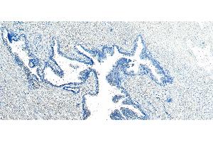 Image no. 8 for anti-Vacuolar Protein Sorting 35 (VPS35) (C-Term) antibody (ABIN185182)