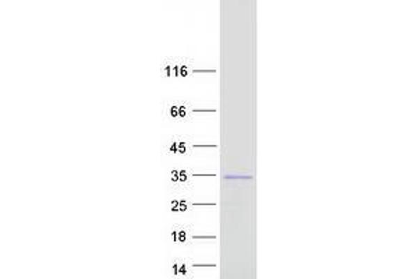 Unc-119 Homolog B (UNC119B) protein (Myc-DYKDDDDK Tag)