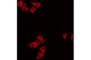 Image no. 2 for anti-DIRAS Family, GTP-Binding RAS-Like 1 (DIRAS1) antibody (ABIN6261302)